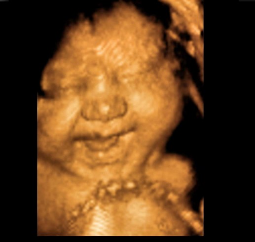 3D 4D ultrasound Riverside
